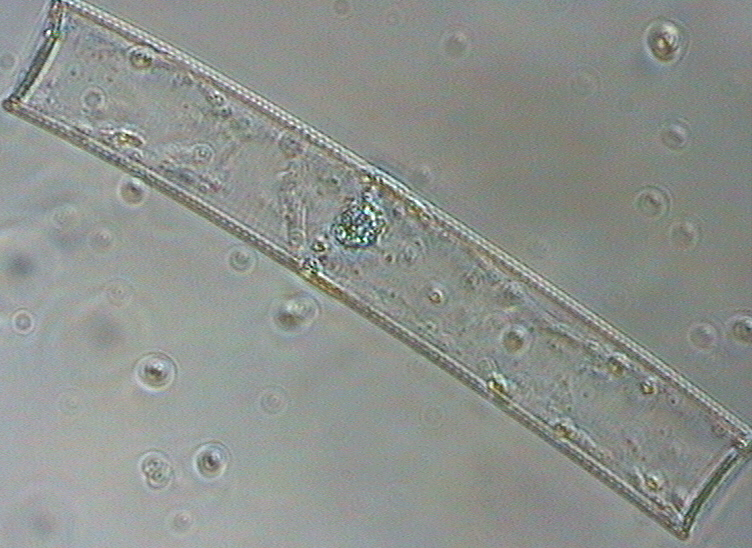 Dictyocha speculum